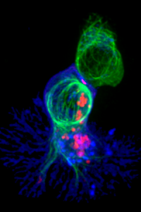 Blue, pink and green immunofluorescent image of a killer t-cell